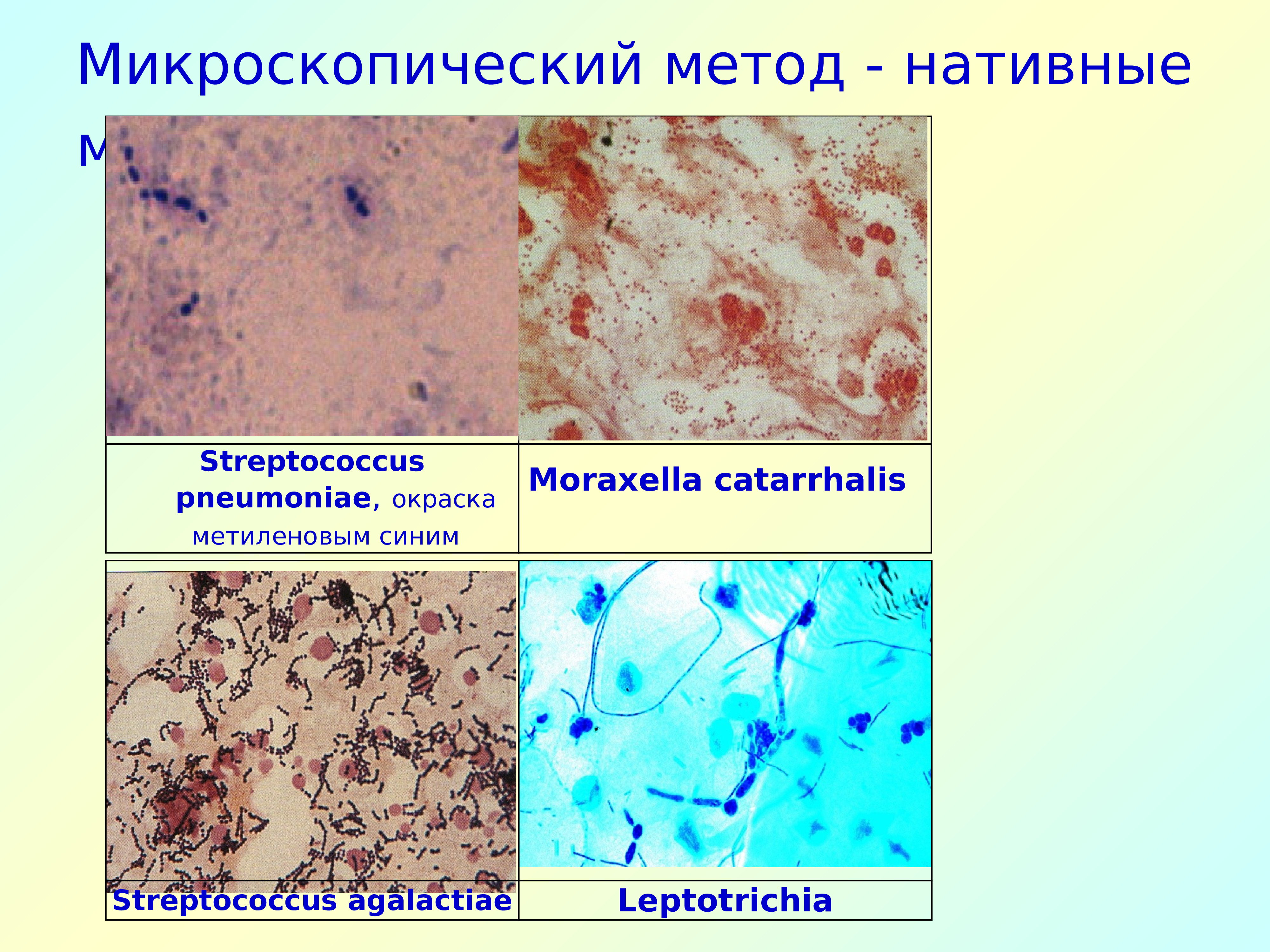 Микроскопическое исследование соскоба. Метод нативного мазка. Микроскопический метод методы окрашивания. Метод нативного мазка гельминтов. Метод нативного мазка паразитология.