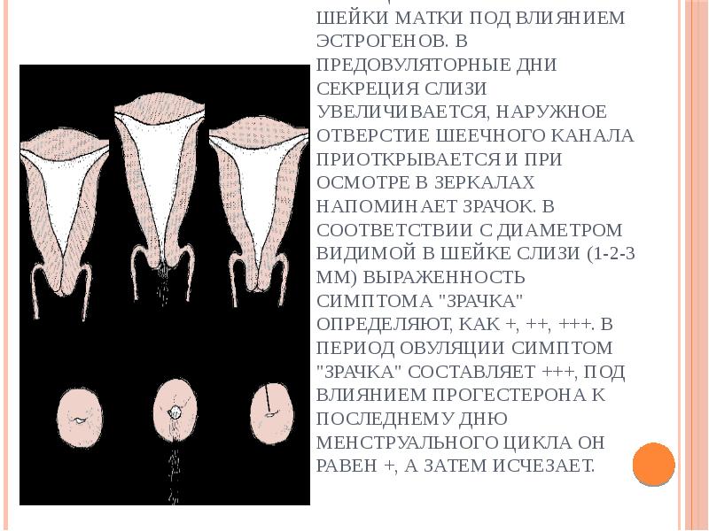 • Симптом "зрачка" отражает секрецию слизи железами шейки матки под влиянием • Симптом "зрачка" отражает секрецию слизи железами шейки матки под влиянием