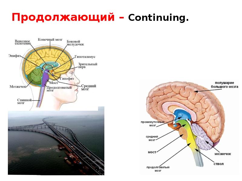 Боковой мозг. Отделы боковых желудочков конечного мозга. Конечный мозг таблица. Объемные процессы головного мозга презентация. Венозные сплетения боковых желудочков.