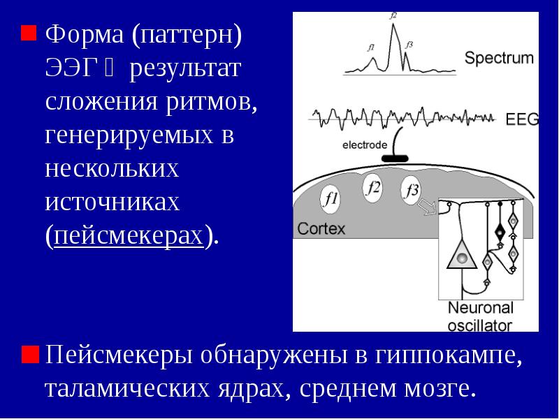 Пейсмекер