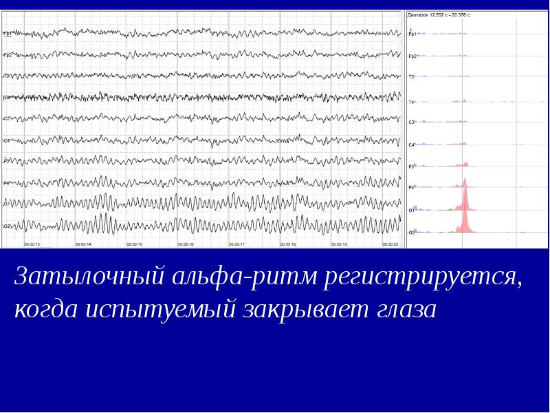 Принцип метода электроэнцефалографии нарисовать и охарактеризовать основные волны ээг