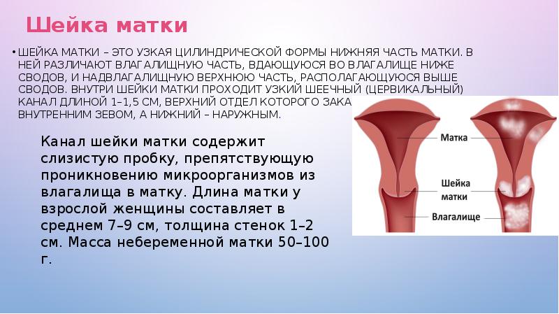 Шейка цилиндрической формы. Формы шейки матки коническая и цилиндрическая. Шейка матки конической формы. Шейка матки цилиндрической формы. Коническая и цилиндрическая шейка матки.