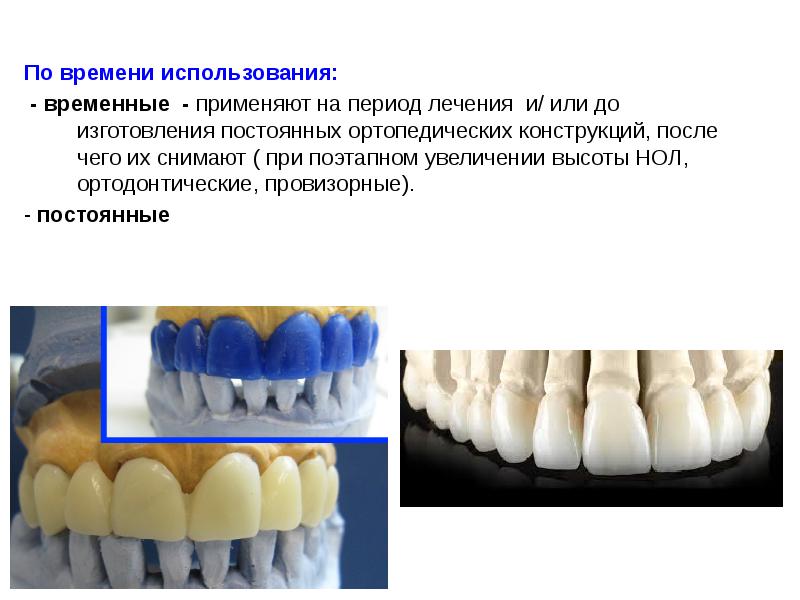 Временные коронки презентация