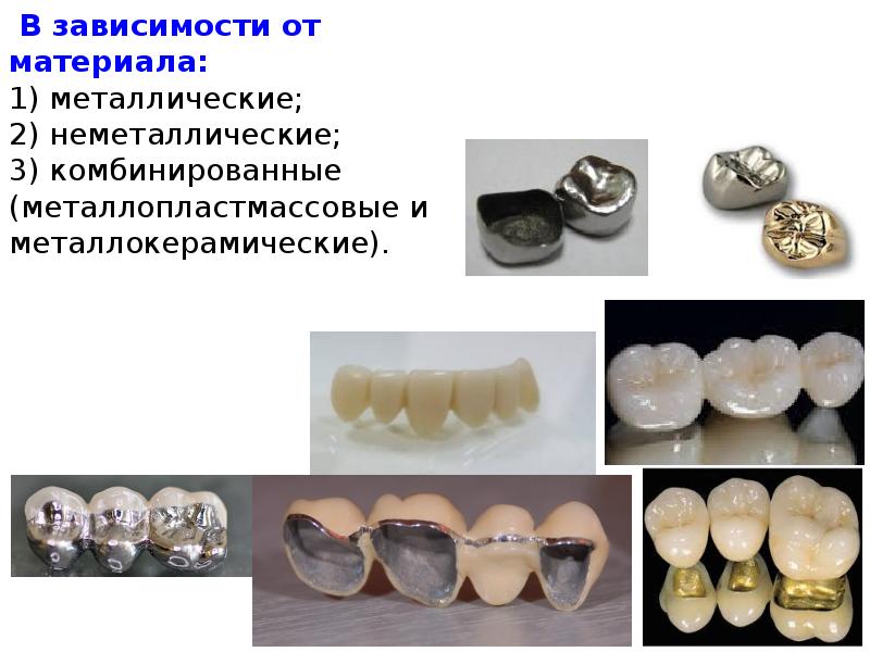 Современные технологии искусственных коронок презентация