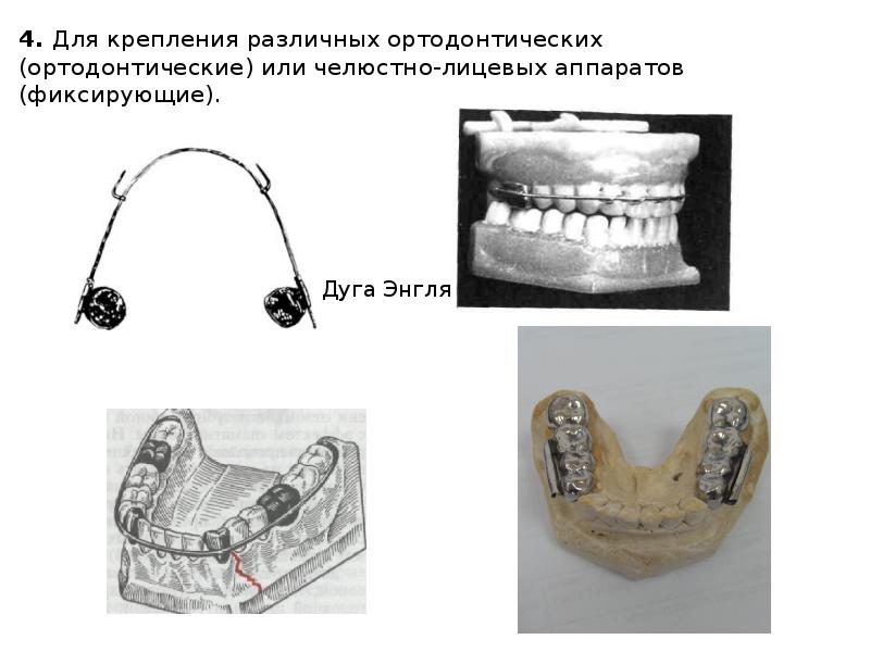 Искусственные коронки презентация