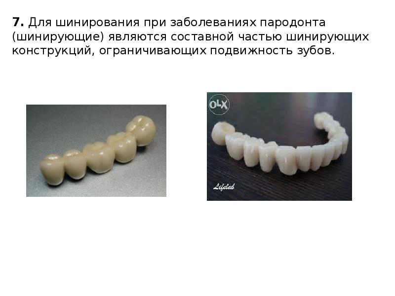 Пластмассовые коронки презентация