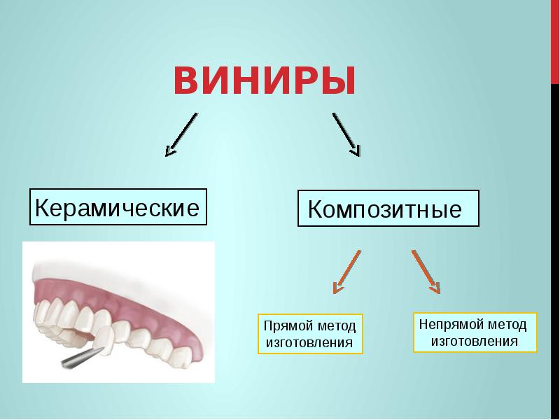 Изготовление виниров презентация