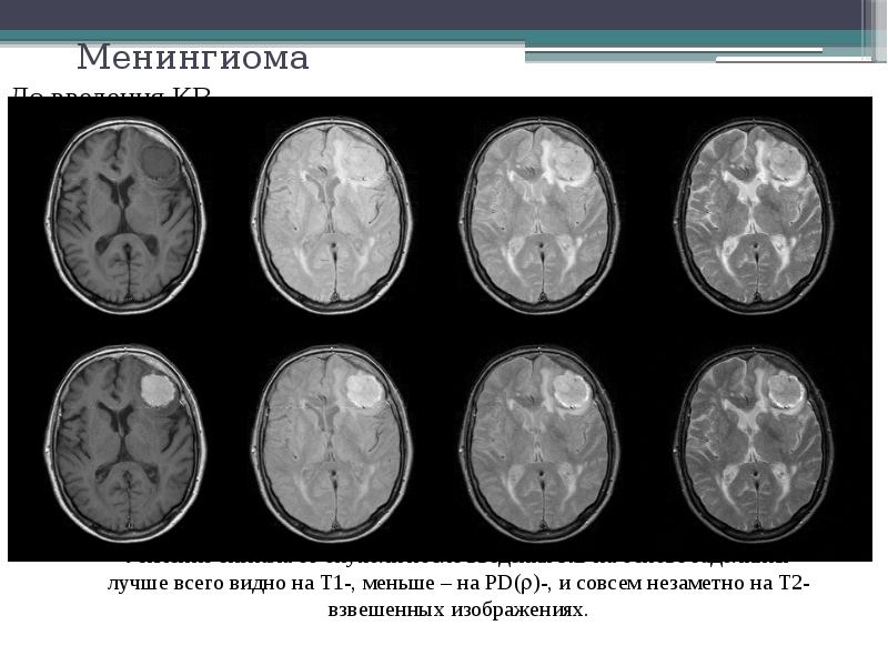 Презентация на тему мрт