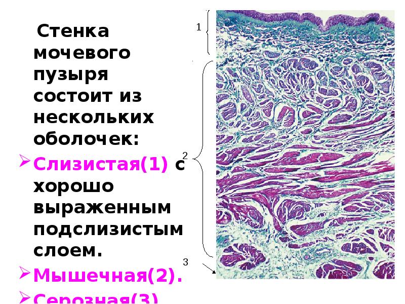 Стенки мочеточника