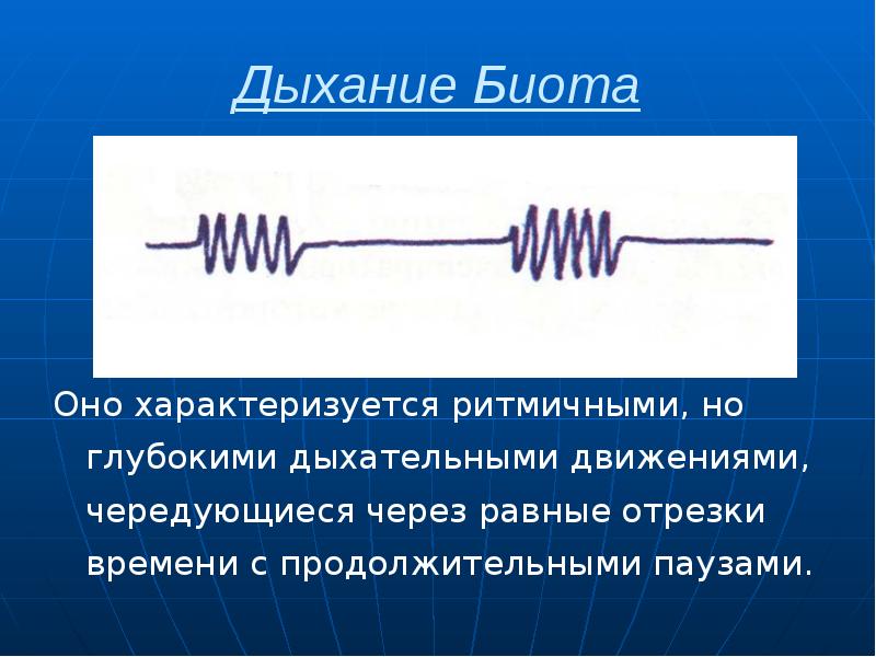 Дыхание Биота Оно характеризуется ритмичными, но глубокими дыхательными движениями, чередующиеся через