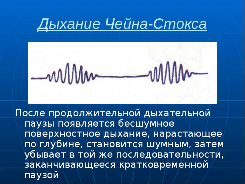 Дыхание Чейна-Стокса После продолжительной дыхательной паузы появляется бесшумное поверхностное дыхание, нарастающее