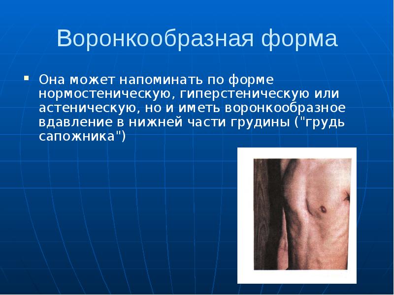 Воронкообразная форма Она может напоминать по форме нормостеническую, гиперстеническую или астеническую,