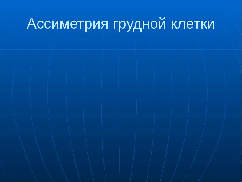 Ассиметрия грудной клетки