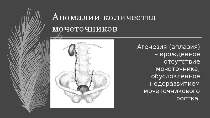 Агенезия венозного протока