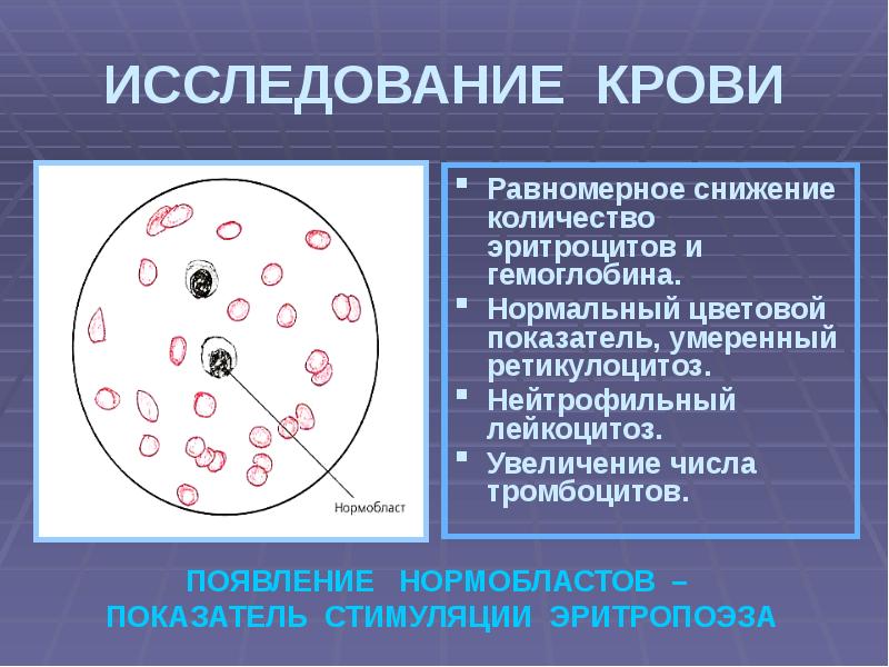 Анемия пропедевтика внутренних болезней презентация