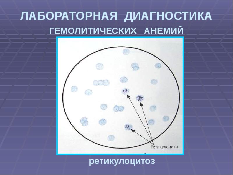 Анемия пропедевтика внутренних болезней презентация