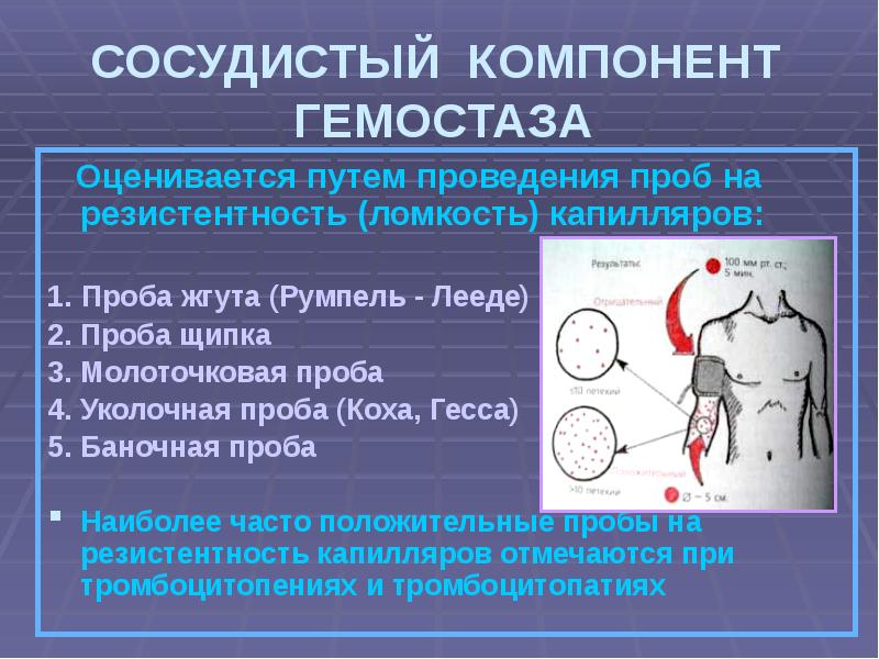 Геморрагический синдром пропедевтика внутренних болезней презентация