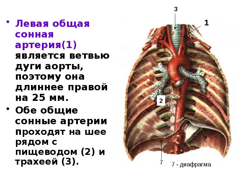 Левая сонная артерия. Сонная артерия и аорта. Левая общая Сонная артерия. Левая общая Сонная арт. Левая общая Сонная артерия ветви.