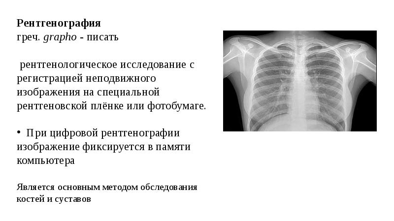 Единица цифрового изображения на рентгенограмме это