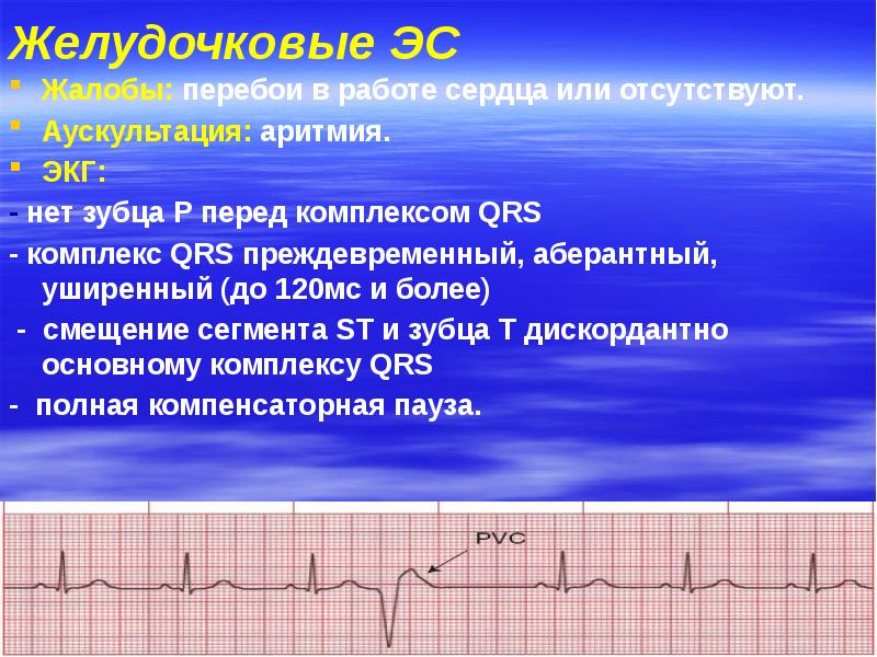 Нарушение ритма сердца у детей презентация