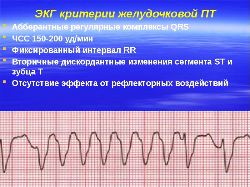 Нарушение ритма у детей презентация