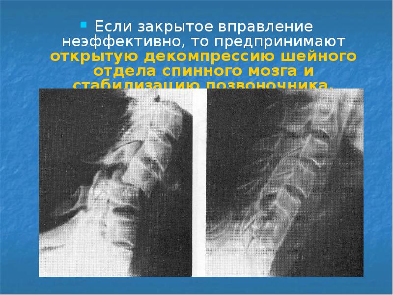 Спинальная травма в свете диагностических изображений