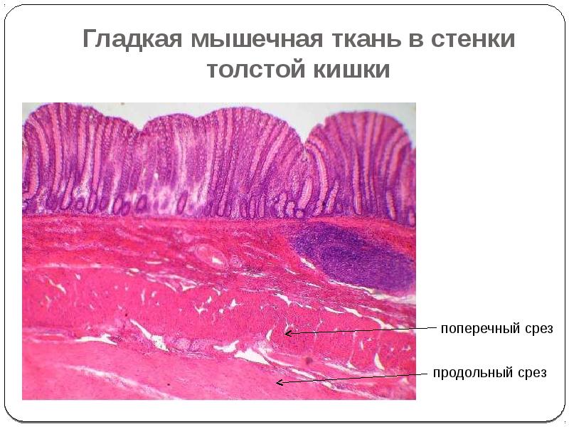 Стенка тонкого кишечника гистология