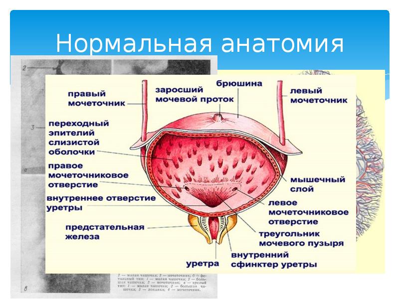 Мочевой пузырь на схеме человека