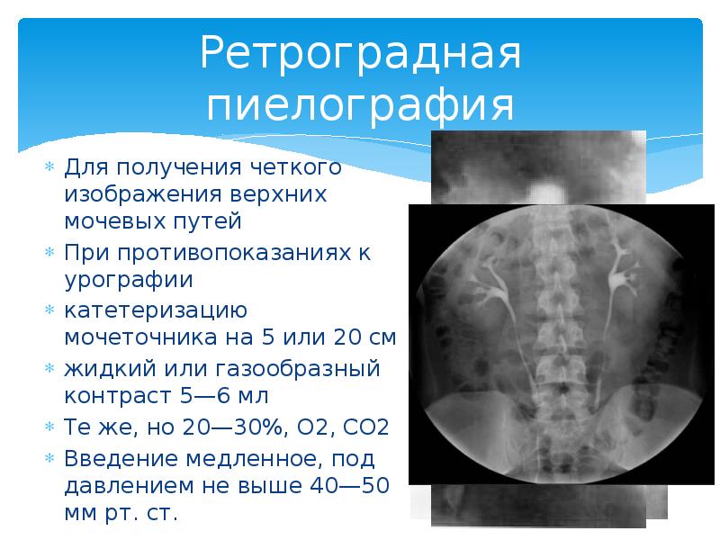 Для получения четкого изображения