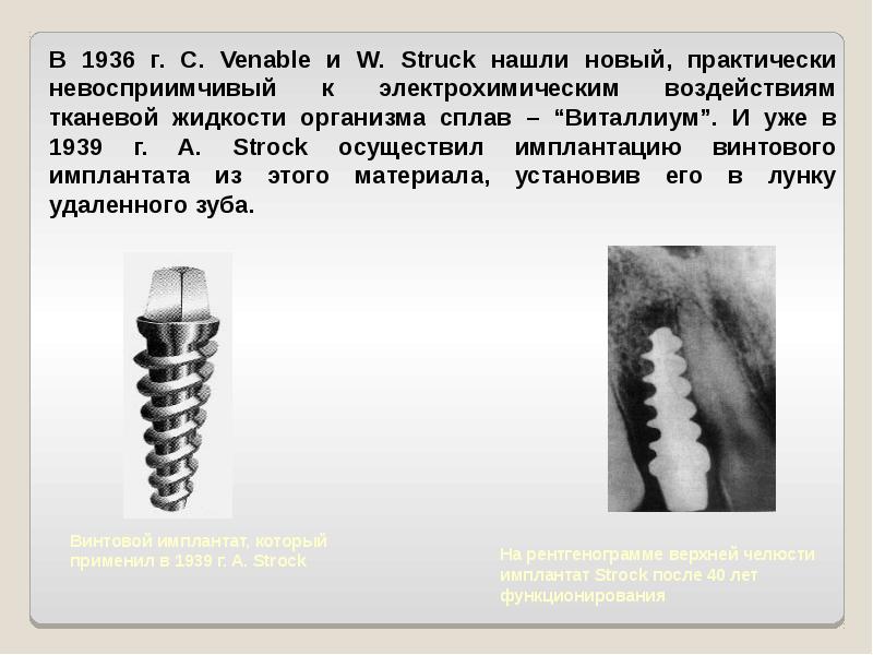 История имплантации зубов презентация