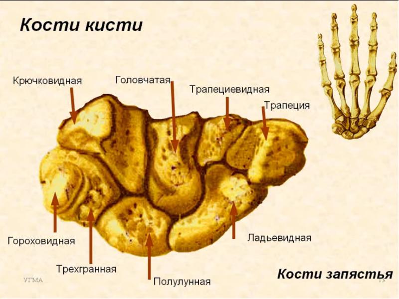 Гороховидная кость. Анатомия ладьевидная кость пястья. Крючковидная кость запястья. Крючковидная кость запястья анатомия. Верхний ряд костей запястья.