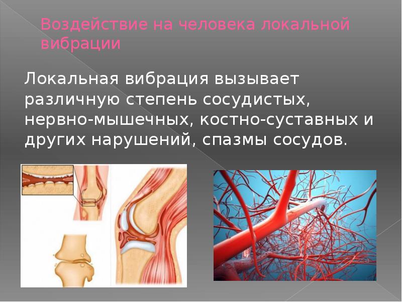 Влияние шума и вибрации на здоровье человека презентация