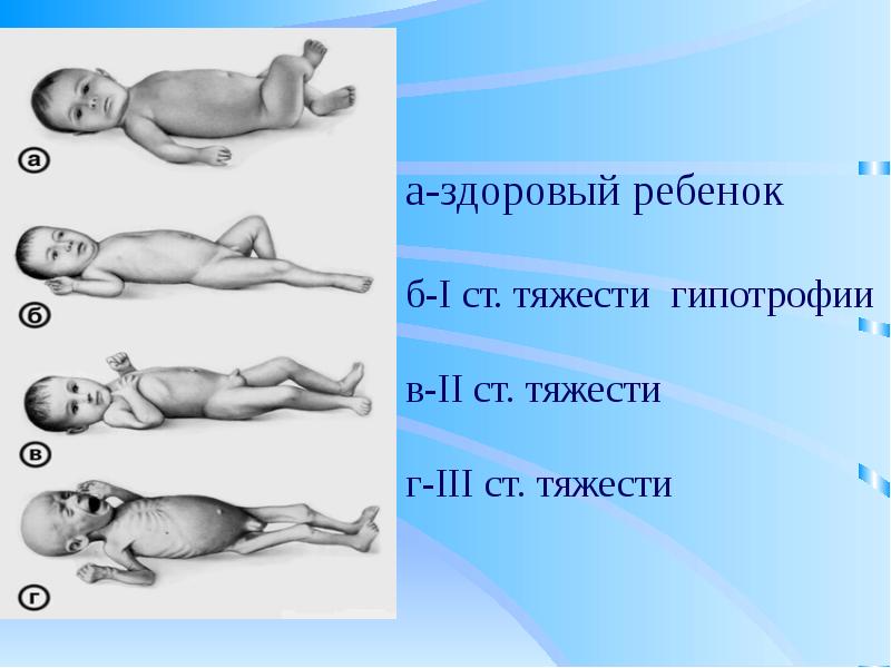 Дистрофия презентация патология