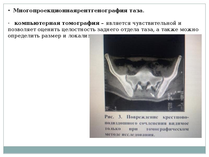 Травмы таза травматология презентация