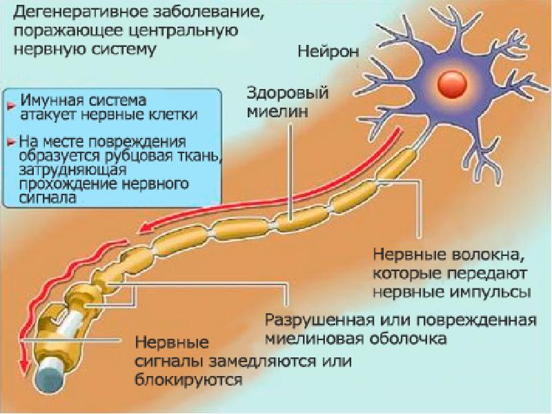Разрушенная нервная система