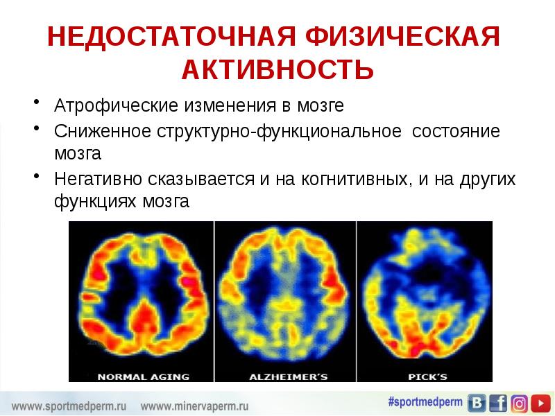 Функциональные состояния головного мозга