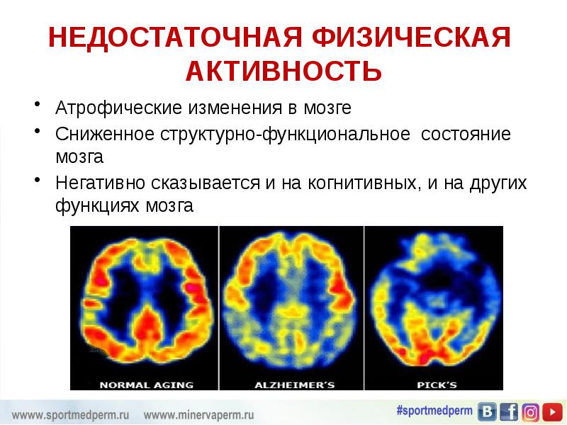 Состояние мозга. Состояния мозга. Функциональные состояния мозга. Функциональное состояние и активность мозга. Оценка функционального состояния мозга.