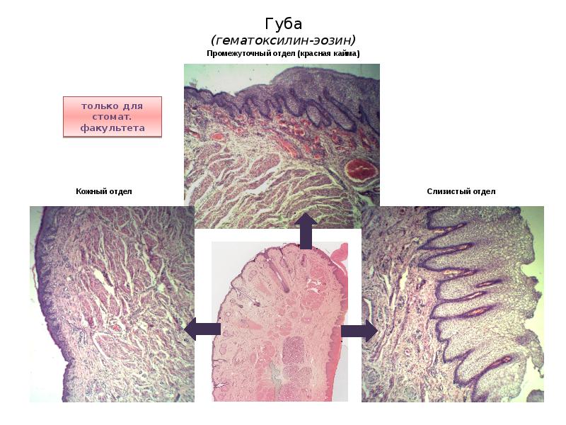 Губа гистология рисунок