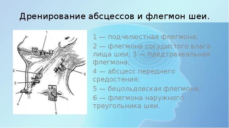 Презентация операции на шее