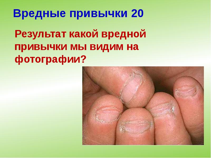 Вредные привычки 20 Вредные привычки 20