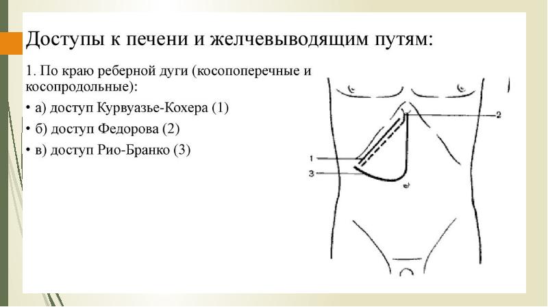 Оперативные доступы к печени
