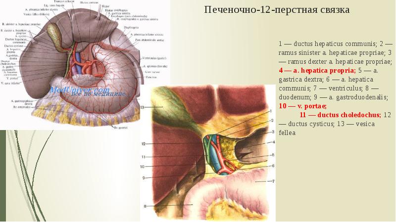 Печеночно-12-перстная связка 1 — ductus hepaticus communis; 2 — ramus sinister