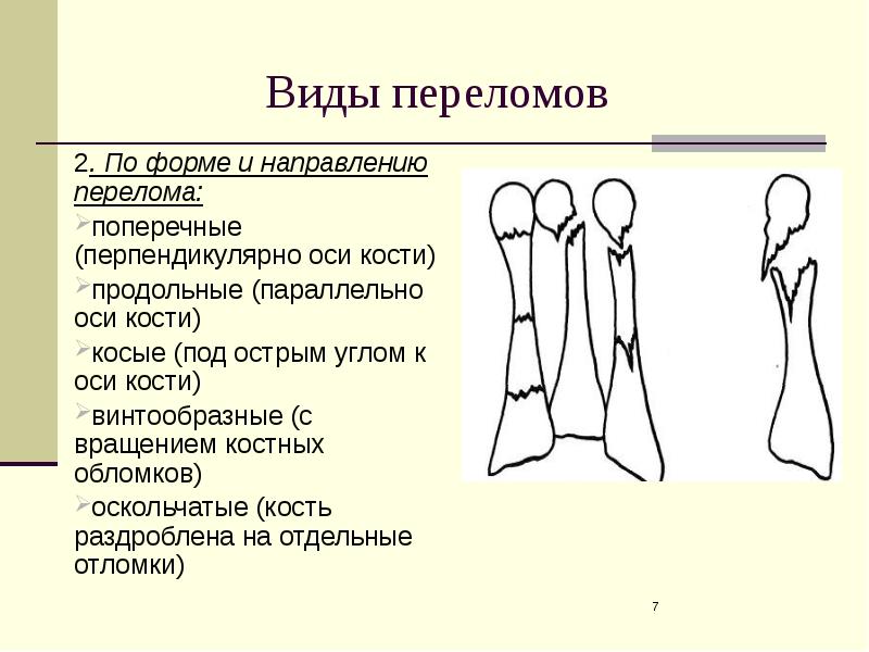 Презентации на тему переломы