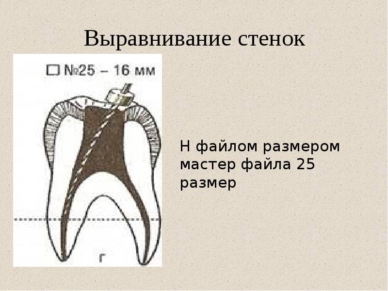 Выравнивание стенок