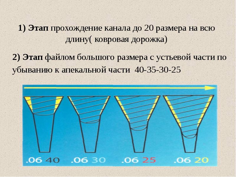 1) Этап прохождение канала до 20 размера на всю длину( ковровая