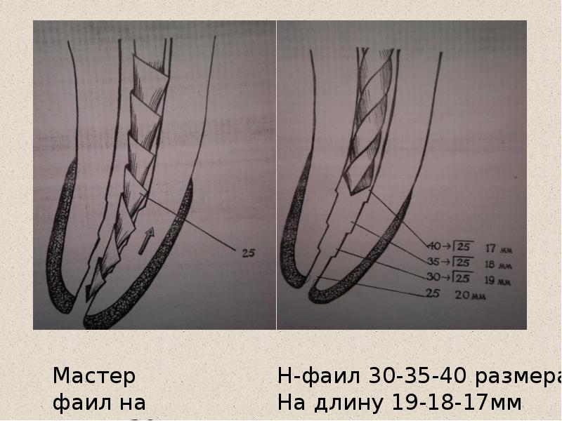 Степ бэк схема