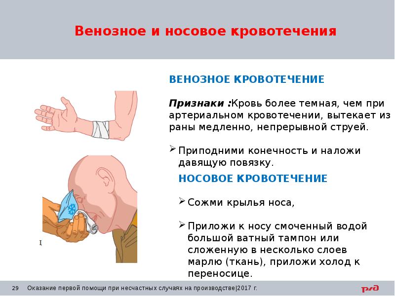 Картинка первая помощь при венозном кровотечении