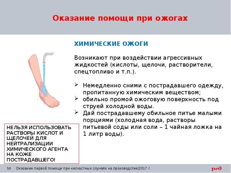 Чем обезболить ожог