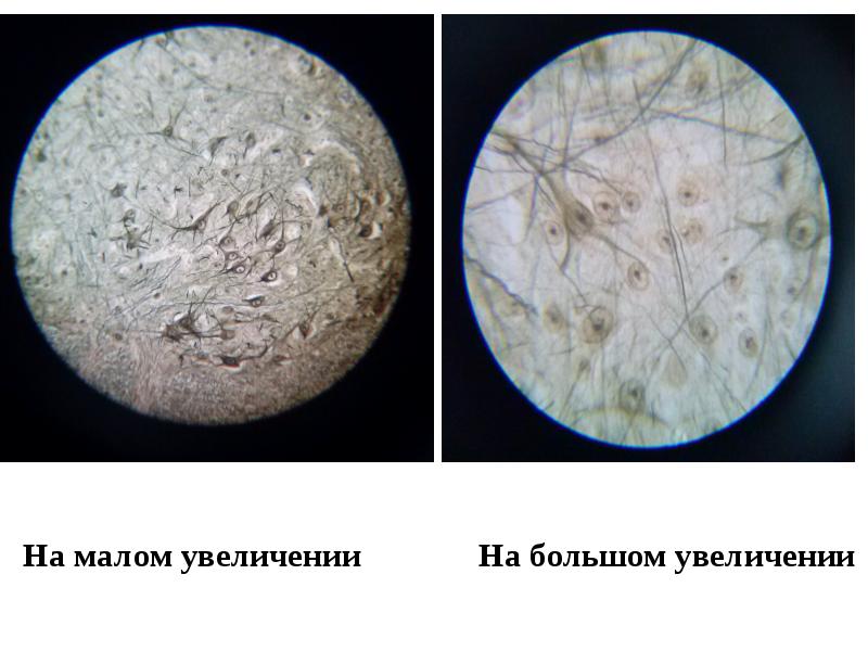 Что такое увеличение. Корона Радиата гистология на Малом и большом оптическом увеличении. Малое и большое увеличение. Карту в самом большом увеличении.