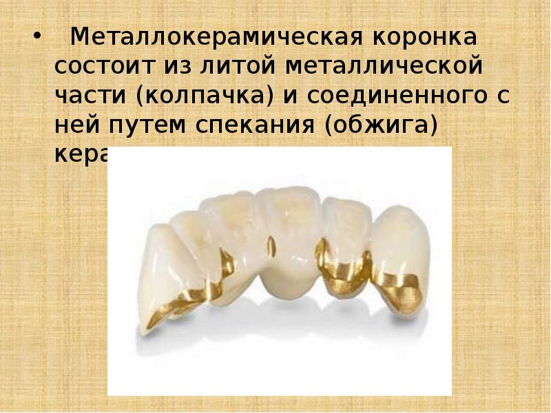 Цельнолитые коронки презентация